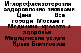 Иглорефлексотерапия, оздоровление пиявками › Цена ­ 3 000 - Все города, Москва г. Медицина, красота и здоровье » Медицинские услуги   . Крым,Бахчисарай